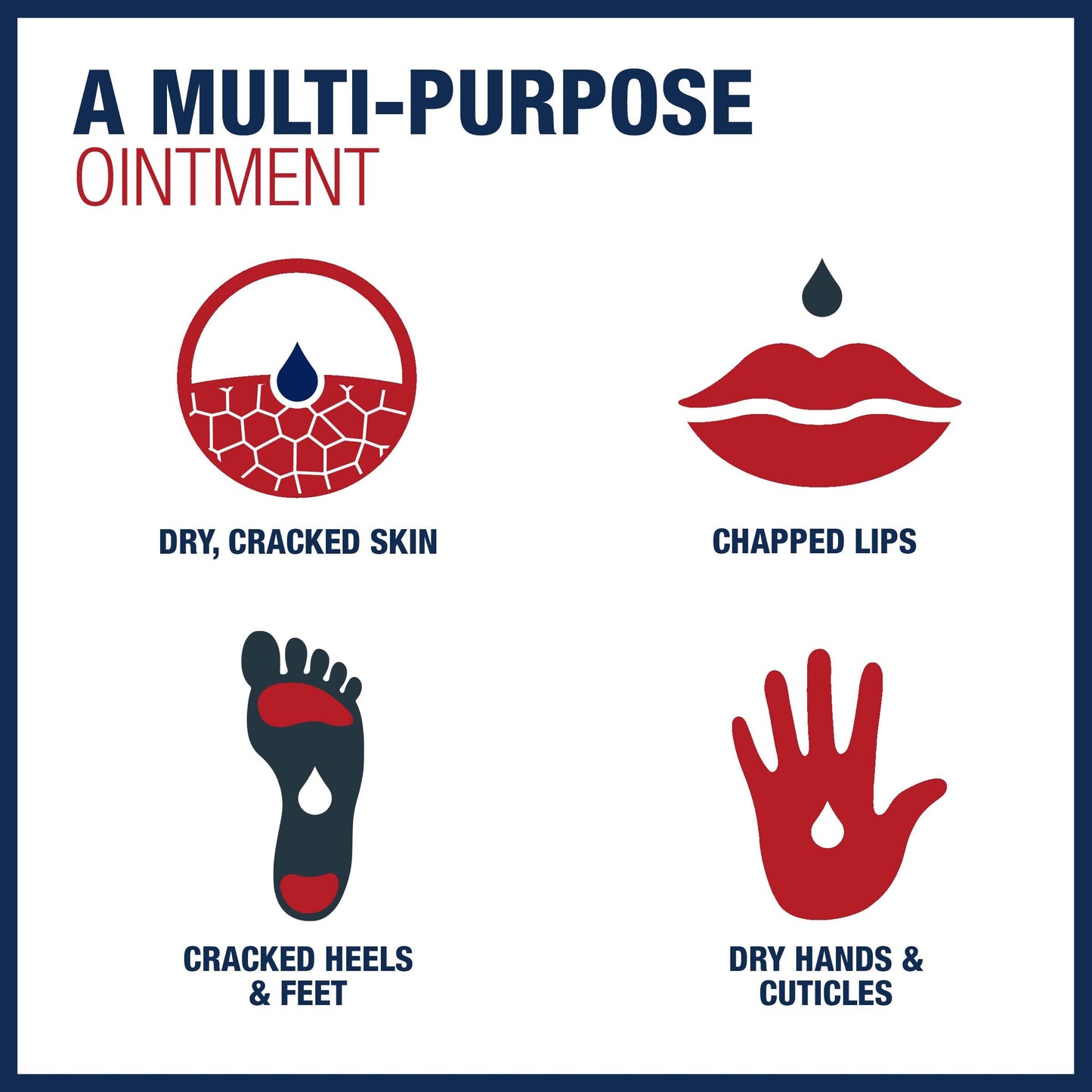 Aquaphor Healing Ointment Advanced Therapy Skin Protectant, Dry Skin Body Moisturizer, 3.5 Ounce (Pack of 3)